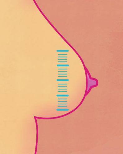 breast-pumps-do-i-need-one