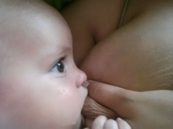 Breastfeeding with a cleft lip and cleft palate 