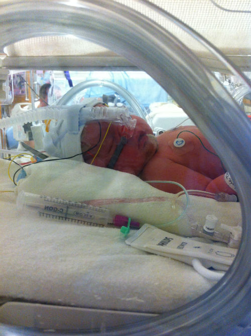 lactation after loss and the donation of breast milk