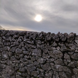 A Breastfeeding Mother and Her Newborn’s Drug Withdrawal