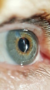 Dry Eyes in Menopause Something to Cry About