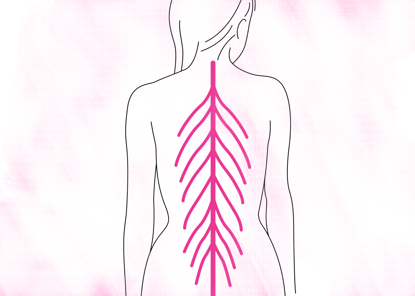 Multiple Sclerosis and the Impact of Breastfeeding